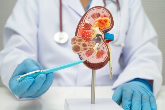 Chronic disease management 