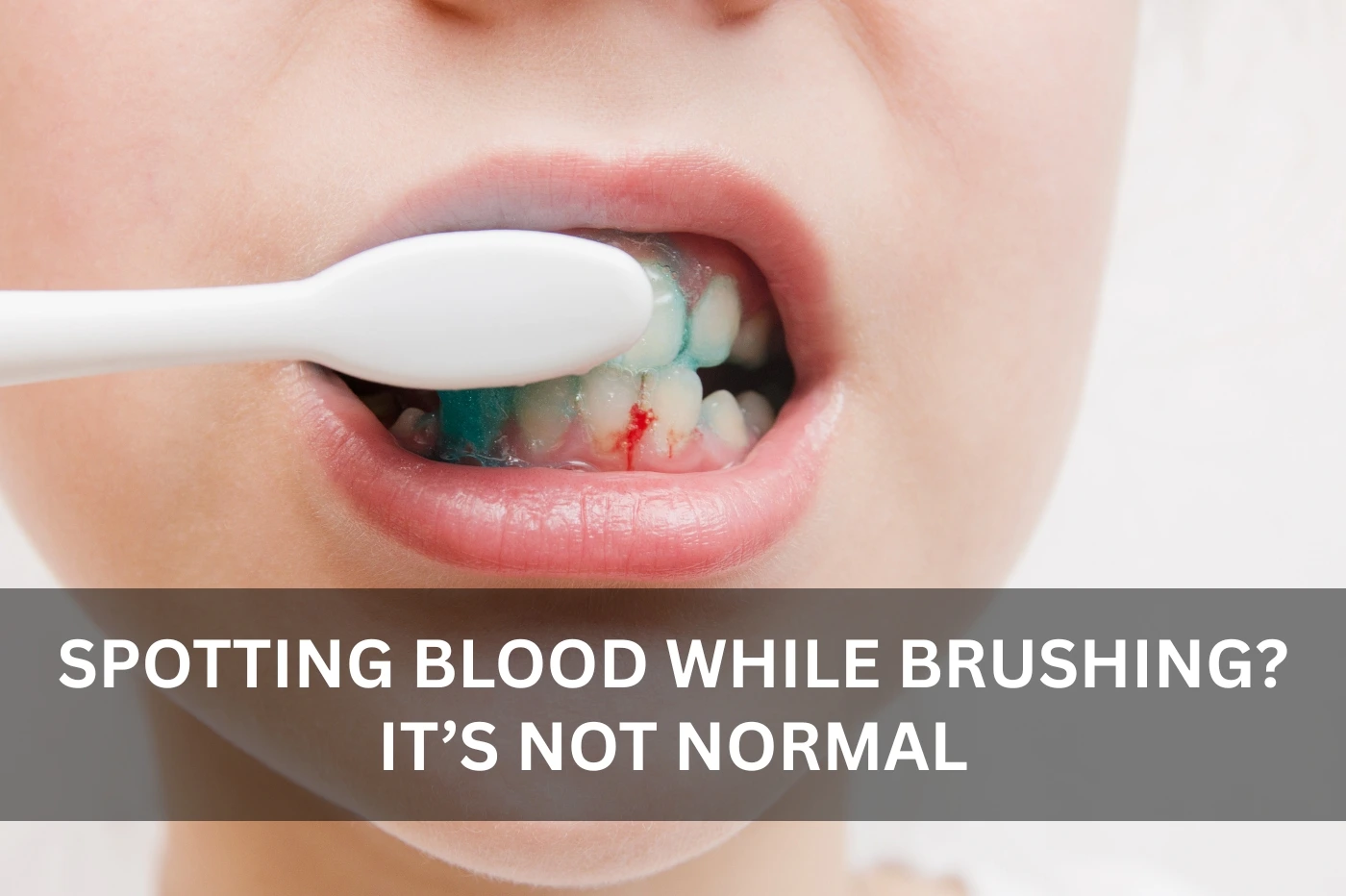 Gum Disease Treatment in Bur Dubai
